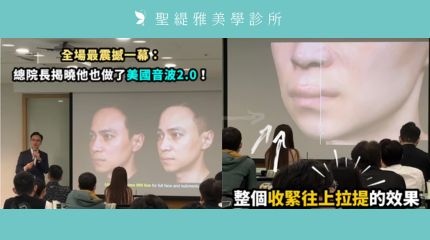 #聖緹雅美學 ｜皮膚專科陳振豐 醫師以自己為例，親自站上講台，分享 #美國音波二代 的實證成果。 圖片