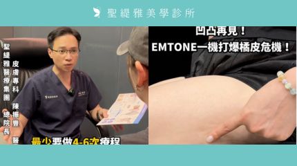 #聖緹雅美學 ｜【#EMTONE】掃蕩橘皮，不留痕！ 圖片