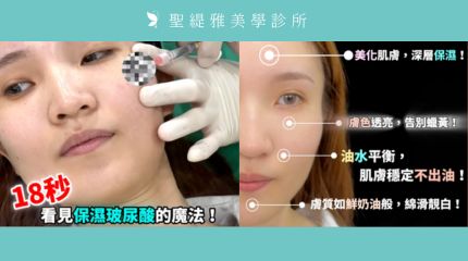 #聖緹雅美學 ｜Volite肌因煥膚針 這是一種『為肌膚補上時間流失的彈性』，而不是外加一層改變。 圖片